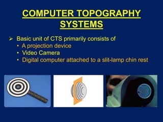 COMPUTER TOPOGRAPHY
SYSTEMS
 Basic unit of CTS primarily consists of
• A projection device
• Video Camera
• Digital computer attached to a slit-lamp chin rest
 