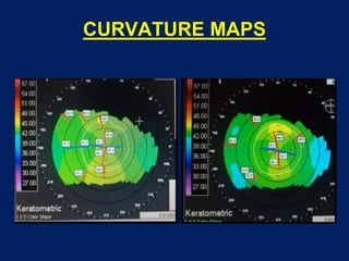 CURVATURE MAPS
 