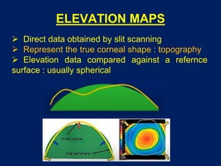 ELEVATION MAPS
 Direct data obtained by slit scanning
 Represent the true corneal shape : topography
 Elevation data compared against a refernce
surface : usually spherical
 