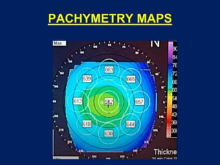 PACHYMETRY MAPS
 