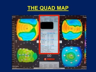 THE QUAD MAP
 