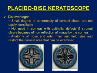 PLACIDO-DISC KERATOSCOPE
 Disadvantages
• Small degree of abnormality of corneal shape are not
easily identifiable
• Not used in corneas with epithelial defects & stromal
ulcers because of non reflection of image by the cornea
• Anatomy of nose and orbit may limit field size and
restrict the corneal area that can be examined
 