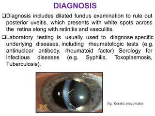 Uveitis Lab Testing 8. uveitis | PPTX