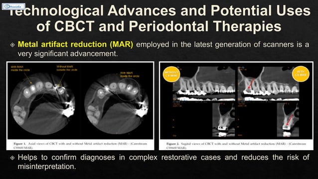 Cbct In Dentistry Ppt : CBCT IN IMPLANTOLOGY.pptx – TSKAT
