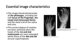 Hand Rotation Distal 8.HAND PART 1.pptx