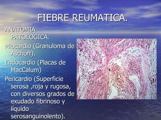 FIEBRE REUMATICA.
ANATOMIA
PATOLOGICA.
Miocardio (Granuloma de
Aschoff).
Endocardio (Placas de
MacCalum)
Pericardio (Superficie
serosa ,roja y rugosa,
con diversos grados de
exudado fibrinoso y
líquido
serosanguinolento).
 