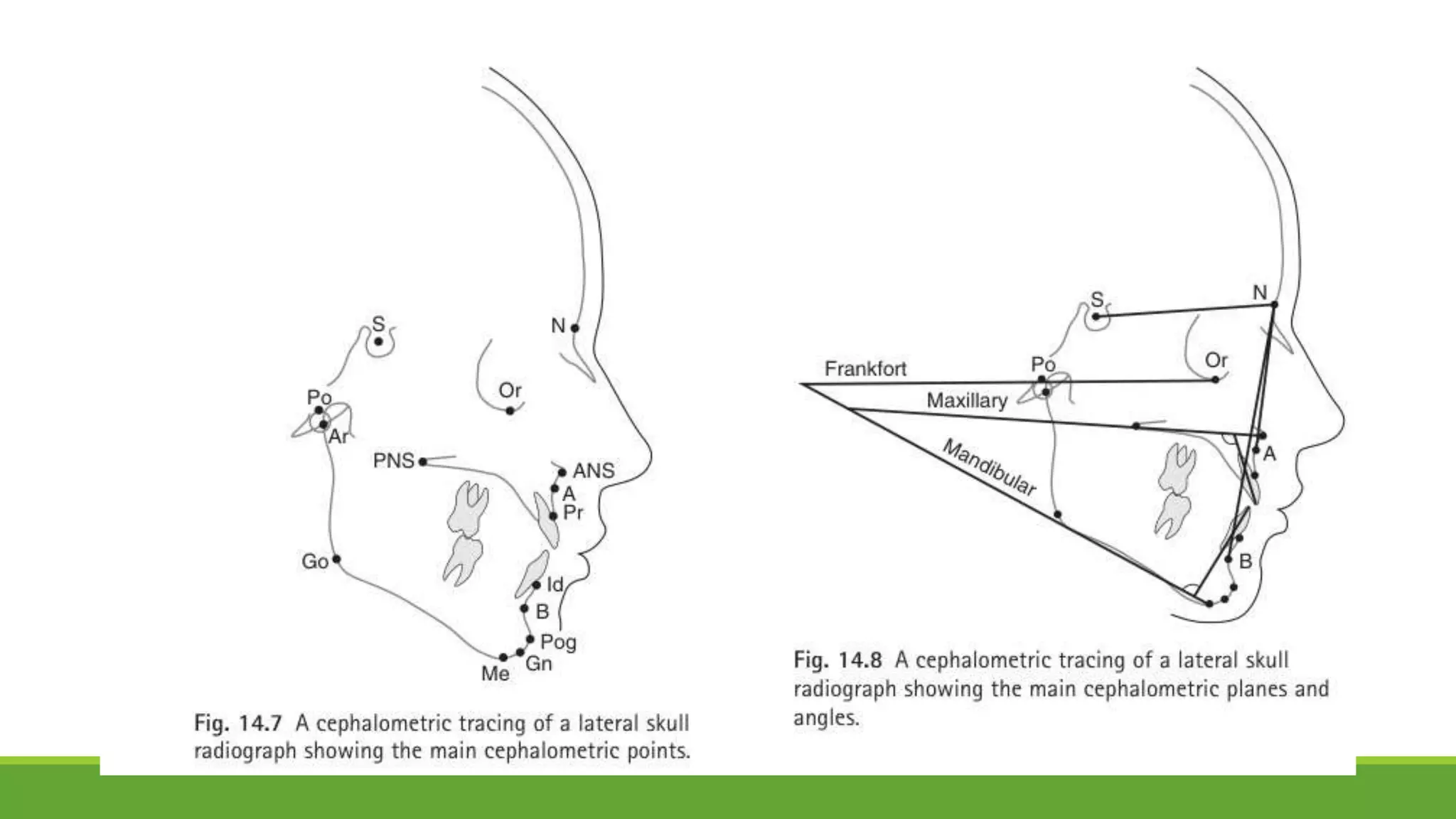 8. Cephalometric Radiography.pptx
