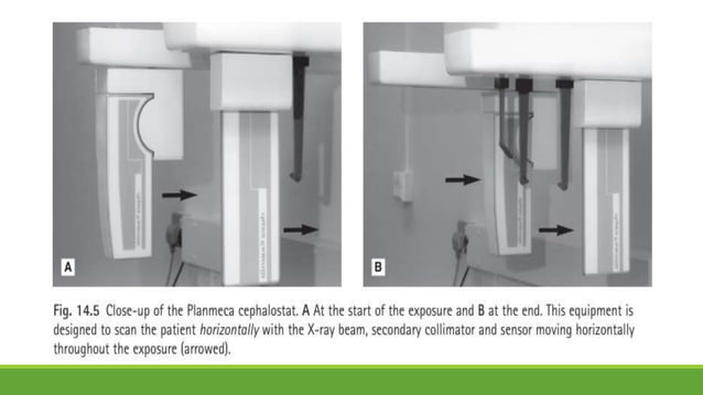 8. Cephalometric Radiography.pptx | Dental Health | Diseases and Conditions