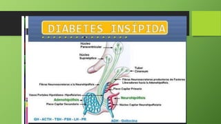 8. DIABETES INSIPIDA.pptx