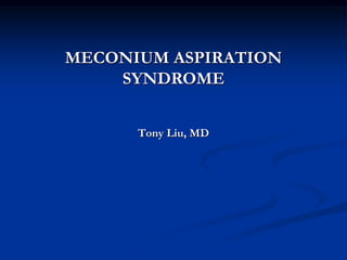 Tony Liu, MD
MECONIUM ASPIRATION
SYNDROME
 