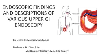 ENDOSCOPIC FINDINGS
AND DESCRIPTIONS OF
VARIOUS UPPER GI
ENDOSCOPY
Presenter; Dr. Malingi Mwalukombe
Moderator: Dr. Eliasa A. M.
Msc (Gastroenterology), Mmed (G. Surgery)
 