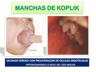 P
PATONOGMONICO A NIVEL DEL 2DO MOLAR
 