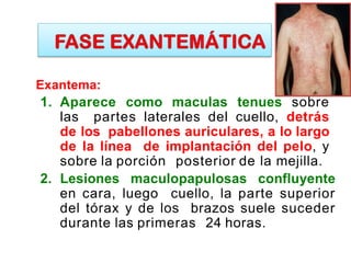 Exantema:
1. Aparece como maculas tenues sobre
las partes laterales del cuello, detrás
de los pabellones auriculares, a lo largo
de la línea de implantación del pelo, y
sobre la porción posterior de la mejilla.
2. Lesiones maculopapulosas confluyente
en cara, luego cuello, la parte superior
del tórax y de los brazos suele suceder
durante las primeras 24 horas.
 