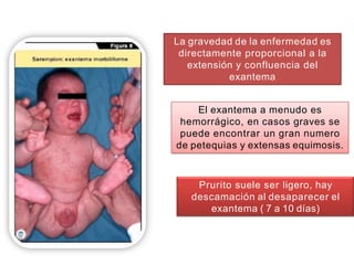 La gravedad de la enfermedad es
directamente proporcional a la
extensión y confluencia del
exantema
El exantema a menudo es
hemorrágico, en casos graves se
puede encontrar un gran numero
de petequias y extensas equimosis.
Prurito suele ser ligero, hay
descamación al desaparecer el
exantema ( 7 a 10 días)
 