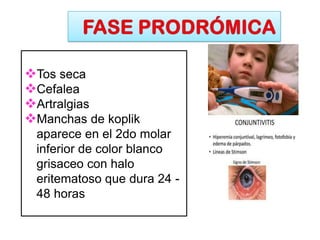 Tos seca
Cefalea
Artralgias
Manchas de koplik
aparece en el 2do molar
inferior de color blanco
grisaceo con halo
eritematoso que dura 24 -
48 horas
 