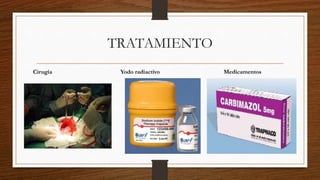 TRATAMIENTO
Cirugía Yodo radiactivo Medicamentos
 