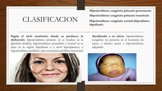 CLASIFICACION
Según el nivel anatómico donde se produzca la
disfunción: hipotiroidismo primario (si se localiza en la
glándula tiroides), hipotiroidismo secundario o central (si se
sitúa en la región hipofisaria o a nivel hipotalámico) o
hipotiroidismo periférico (por resistencia periférica hormonal
Atendiendo a su inicio: hipotiroidismo
congénito (se presenta en el momento de
nacer, o incluso antes) o hipotiroidismo
adquirido
Hipotiroidismo congénito primario permanente
Hipotiroidismo congénito primario transitorio
Hipotiroidismo congénito central (hipotálamo-
hipofisario
 