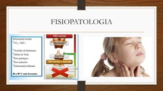 FISIOPATOLOGIA
 