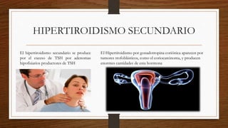HIPERTIROIDISMO SECUNDARIO
El hipertiroidismo secundario se produce
por el exceso de TSH por adenomas
hipofisiarios productores de TSH
El Hipertiroidismo por gonadotropina coriónica aparecen por
tumores trofoblásticos, como el coriocarcinoma, y producen
enormes cantidades de esta hormona
 