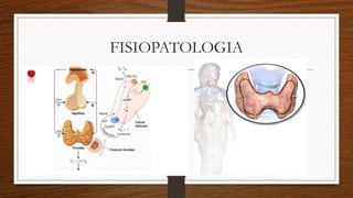 FISIOPATOLOGIA
 