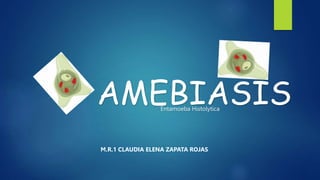 AMEBIASIS
Entamoeba Histolytica
M.R.1 CLAUDIA ELENA ZAPATA ROJAS
 
