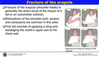 © 2021, Haramaya University
Department of Emergency and Critical Care Nursing
Basic First Aid and Emergency Care
By:- Ame Mehadi (BSc, MSc)
Fracture of the scapula
Fracture of the scapula (shoulder blade) is
generally the direct result of the impact of a
fall or an automobile collision.
Dislocations of the shoulder joint, sprains
and contusions are common in this area.
First aid consists of applying a sling and
bandaging the victim’s upper arm to his
chest wall.
Applying arm sling for fracture of the
scapula
 