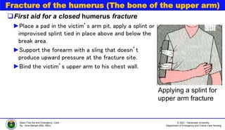 © 2021, Haramaya University
Department of Emergency and Critical Care Nursing
Basic First Aid and Emergency Care
By:- Ame Mehadi (BSc, MSc)
Fracture of the humerus (The bone of the upper arm)
First aid for a closed humerus fracture
►Place a pad in the victim’s arm pit, apply a splint or
improvised splint tied in place above and below the
break area.
►Support the forearm with a sling that doesn’t
produce upward pressure at the fracture site.
►Bind the victim’s upper arm to his chest wall.
Applying a splint for
upper arm fracture
 