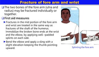 Fracture of fore arm and wrist
The two bones of the fore arm (ulna and
radius) may be fractured individually or
together.
First aid measures
►Fractures in the mid portion of the fore arm
and wrist are treated in the same way as
fractures of the shaft of the humerus.
Immobilize the broken bone ends at the wrist
and the elbow, by applying well –padded
splints on each side.
►Bend the elbow and apply a sling with a
slight elevation keeping the thumb pointing
upward. Splinting the fore arm
 