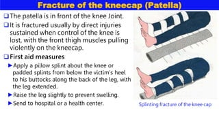 Fracture of the kneecap (Patella)
The patella is in front of the knee Joint.
It is fractured usually by direct injuries
sustained when control of the knee is
lost, with the front thigh muscles pulling
violently on the kneecap.
First aid measures
►Apply a pillow splint about the knee or
padded splints from below the victim’s heel
to his buttocks along the back of the leg, with
the leg extended.
►Raise the leg slightly to prevent swelling.
►Send to hospital or a health center. Splinting fracture of the knee cap
 