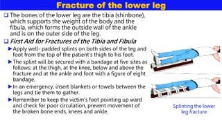 Fracture of the lower leg
 The bones of the lower leg are the tibia (shinbone),
which supports the weight of the body and the
fibula, which forms the outside wall of the ankle
and is on the outer side of the leg.
 First Aid for Fractures of the Tibia and Fibula
►Apply well- padded splints on both sides of the leg and
foot from the top of the patient’s thigh to his foot.
►The splint will be secured with a bandage at five sites as
follows: at the thigh, at the knee, below and above the
fracture and at the ankle and foot with a figure of eight
bandage.
►In an emergency, insert blankets or towels between the
legs and tie them to gather.
►Remember to keep the victim’s foot pointing up ward
and check for poor circulation, prevent movement of
the broken bone ends, knees and ankle.
Splinting the lower
leg fracture
 