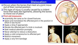 Dislocation:
 Occurs when the bones that meet at a joint move
out of their normal position.
 This type of injury is usually caused by a violent
force that tears the ligaments, allowing the bones
to move out of place.
 First aid measures
►essentially the same as for closed fractures.
►Splint and immobilize the affected joint in the position in
which it was found
►Apply a sling if appropriate.
►Elevate the affected part if a limb is involved.
►Seek medical attention promptly.
►Never attempt to reduce a dislocation.
►Apply a cold compress/ice to affected part
►Restrict movement
►Apply a very firm bandage
 