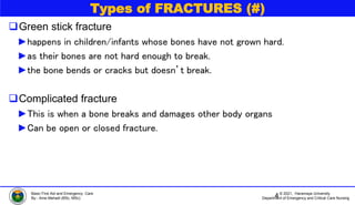 © 2021, Haramaya University
Department of Emergency and Critical Care Nursing
Basic First Aid and Emergency Care
By:- Ame Mehadi (BSc, MSc)
Types of FRACTURES (#)
Green stick fracture
►happens in children/infants whose bones have not grown hard.
►as their bones are not hard enough to break.
►the bone bends or cracks but doesn’t break.
Complicated fracture
►This is when a bone breaks and damages other body organs
►Can be open or closed fracture.
4
 