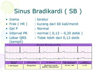 Sinus Bradikardi ( SB )
• Irama : teratur
• Frek ( HR ) : kurang dari 60 kali/menit
• Gel P : Normal
• Interval PR : normal ( 0,12 – 0,20 detik )
• Lebar QRS : Tidak lebih dari 0,12 detik
(sempit)
 