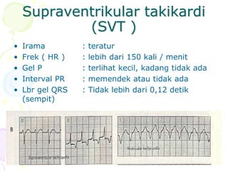 Supraventrikular takikardi
(SVT )
• Irama : teratur
• Frek ( HR ) : lebih dari 150 kali / menit
• Gel P : terlihat kecil, kadang tidak ada
• Interval PR : memendek atau tidak ada
• Lbr gel QRS : Tidak lebih dari 0,12 detik
(sempit)
 