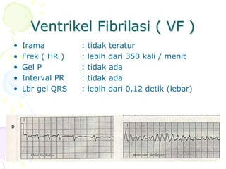 Ventrikel Fibrilasi ( VF )
• Irama : tidak teratur
• Frek ( HR ) : lebih dari 350 kali / menit
• Gel P : tidak ada
• Interval PR : tidak ada
• Lbr gel QRS : lebih dari 0,12 detik (lebar)
 