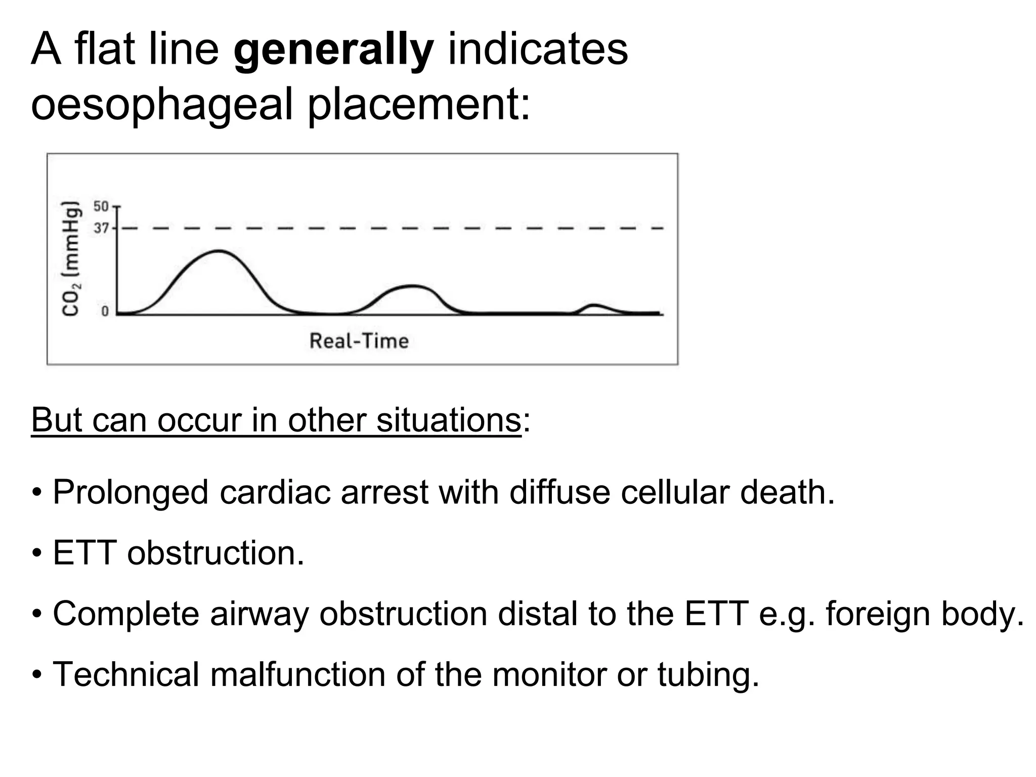 A flat line generally indicates
oesophageal placement:
But can occur in other situations:
• Prolonged cardiac arrest with diffuse cellular death.
• ETT obstruction.
• Complete airway obstruction distal to the ETT e.g. foreign body.
• Technical malfunction of the monitor or tubing.
 