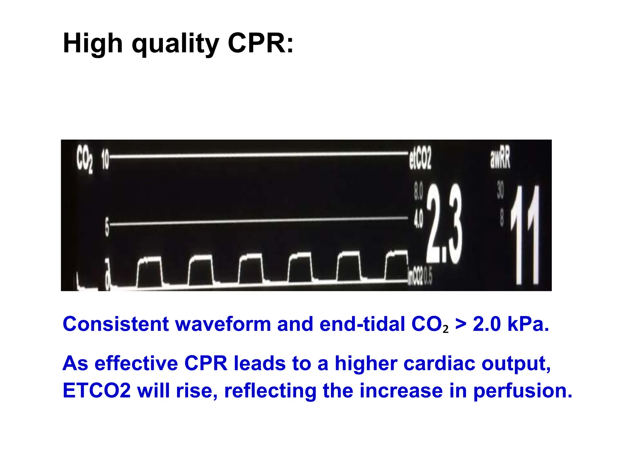 High quality CPR:
Consistent waveform and end-tidal CO₂ > 2.0 kPa.
As effective CPR leads to a higher cardiac output,
ETCO2 will rise, reflecting the increase in perfusion.
 