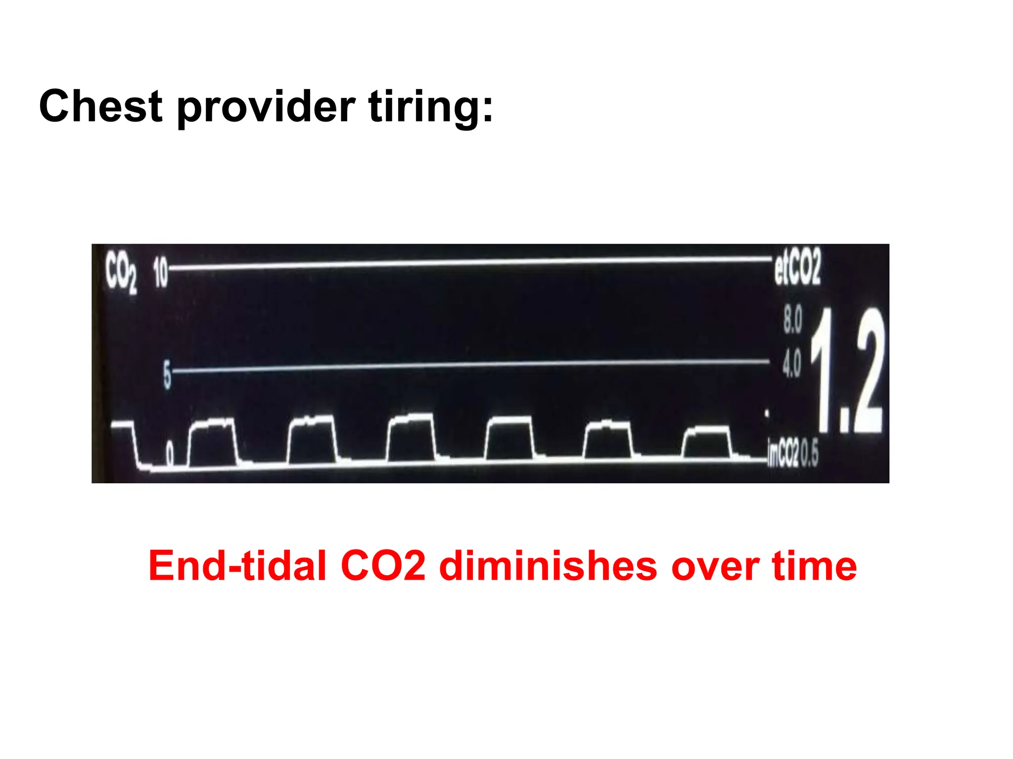 Chest provider tiring:
End-tidal CO2 diminishes over time
 