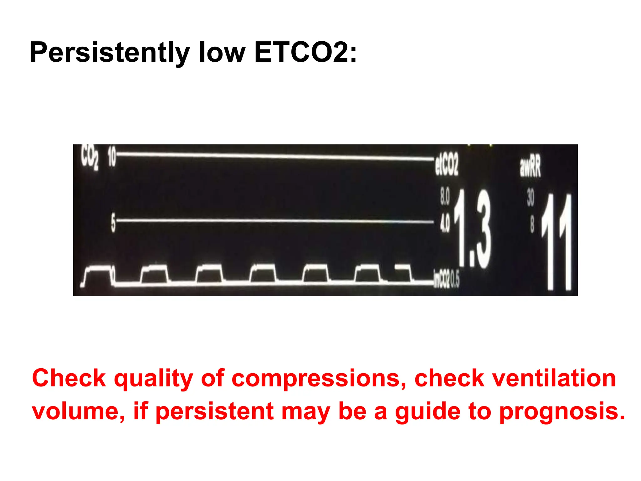 Persistently low ETCO2:
Check quality of compressions, check ventilation
volume, if persistent may be a guide to prognosis.
 
