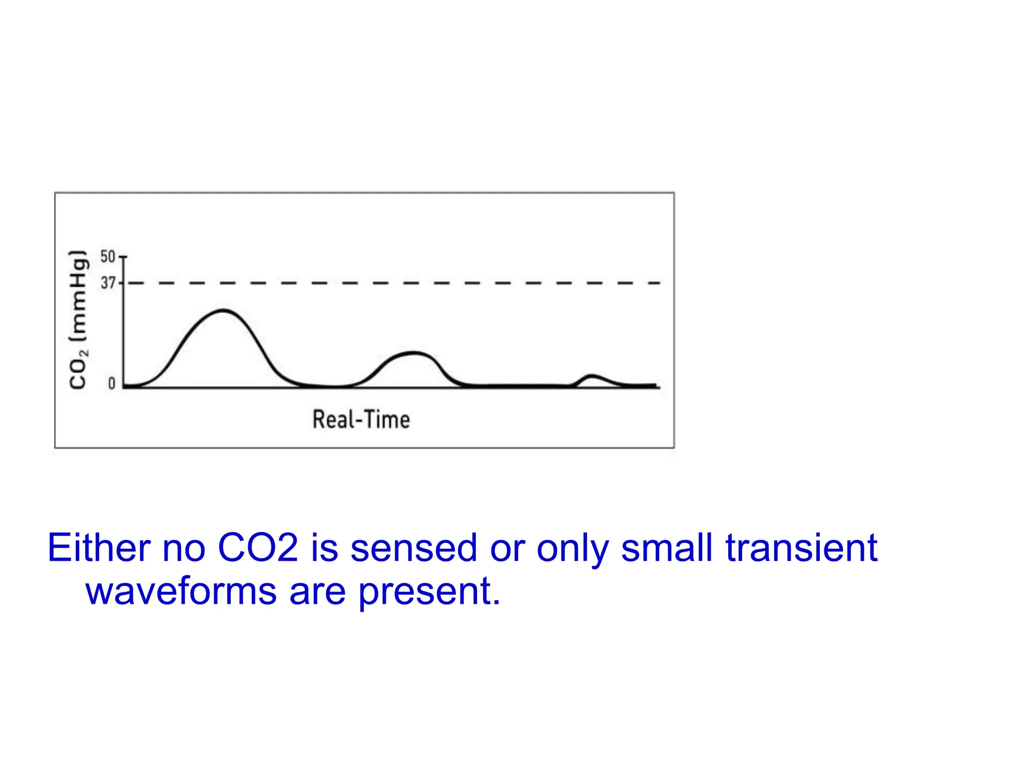 Either no CO2 is sensed or only small transient
waveforms are present.
 