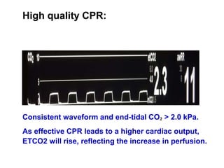 High quality CPR:
Consistent waveform and end-tidal CO₂ > 2.0 kPa.
As effective CPR leads to a higher cardiac output,
ETCO2 will rise, reflecting the increase in perfusion.
 