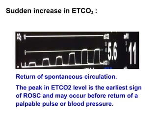 Sudden increase in ETCO₂ :
Return of spontaneous circulation.
The peak in ETCO2 level is the earliest sign
of ROSC and may occur before return of a
palpable pulse or blood pressure.
 