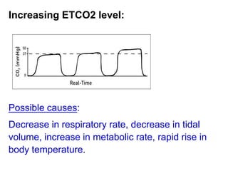 Increasing ETCO2 level:
Possible causes:
Decrease in respiratory rate, decrease in tidal
volume, increase in metabolic rate, rapid rise in
body temperature.
 