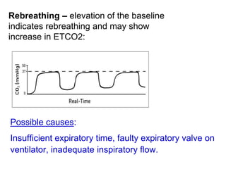 Rebreathing – elevation of the baseline
indicates rebreathing and may show
increase in ETCO2:
Possible causes:
Insufficient expiratory time, faulty expiratory valve on
ventilator, inadequate inspiratory flow.
 