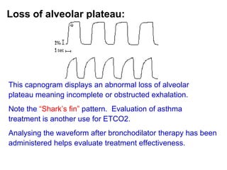Loss of alveolar plateau:
This capnogram displays an abnormal loss of alveolar
plateau meaning incomplete or obstructed exhalation.
Note the “Shark’s fin” pattern. Evaluation of asthma
treatment is another use for ETCO2.
Analysing the waveform after bronchodilator therapy has been
administered helps evaluate treatment effectiveness.
 