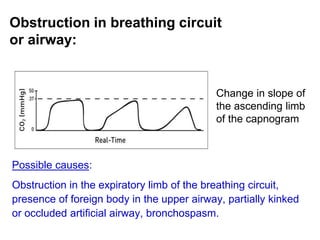 Obstruction in breathing circuit
or airway:
Possible causes:
Obstruction in the expiratory limb of the breathing circuit,
presence of foreign body in the upper airway, partially kinked
or occluded artificial airway, bronchospasm.
Change in slope of
the ascending limb
of the capnogram
 