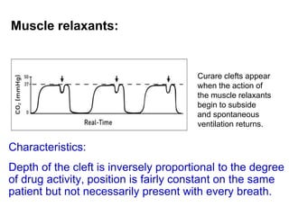 Muscle relaxants:
Characteristics:
Depth of the cleft is inversely proportional to the degree
of drug activity, position is fairly constant on the same
patient but not necessarily present with every breath.
Curare clefts appear
when the action of
the muscle relaxants
begin to subside
and spontaneous
ventilation returns.
 