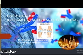 Dr. Armando Benitez Cabrera
Reumatología y Medicina Interna
OSTEOARTROSIS
(ENFERMEDAD ARTICULAR DEGENERATIVA)
 
