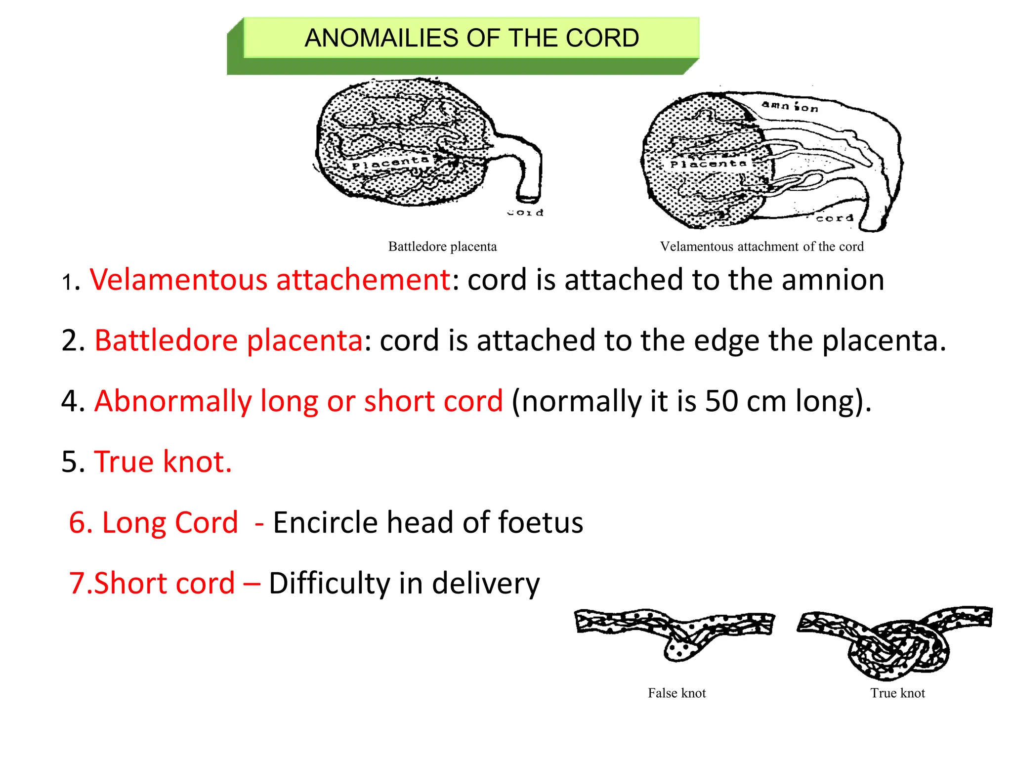 Velamentous attachment of the cord
Battledore placenta
False knot True knot
ANOMAILIES OF THE CORD
1. Velamentous attachement: cord is attached to the amnion
2. Battledore placenta: cord is attached to the edge the placenta.
4. Abnormally long or short cord (normally it is 50 cm long).
5. True knot.
6. Long Cord - Encircle head of foetus
7.Short cord – Difficulty in delivery
 