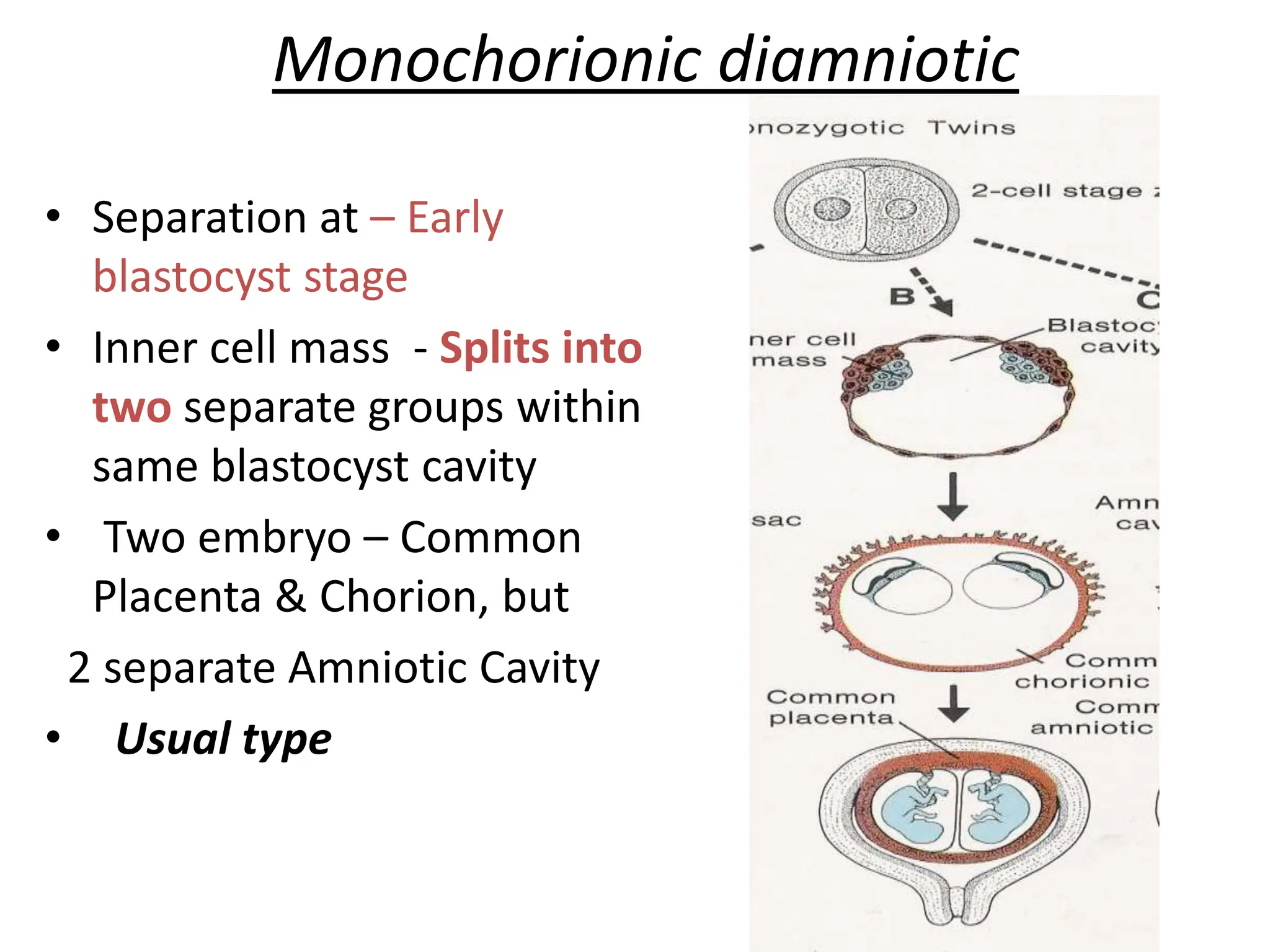 Monochorionic diamniotic
• Separation at – Early
blastocyst stage
• Inner cell mass - Splits into
two separate groups within
same blastocyst cavity
• Two embryo – Common
Placenta & Chorion, but
2 separate Amniotic Cavity
• Usual type
 